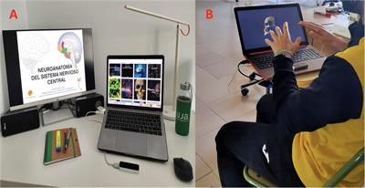 An Innovative Approach for Online Neuroanatomy and Neurorrehabilitation Teaching Based on 3D Virtual Anatomical Models Using Leap Motion Controller During COVID-19 Pandemic